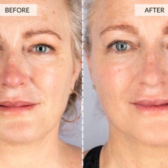 CurrentBody Skin LED Light Therapy Face Mask The world’s most powerful anti-agin - Picture 6 of 16